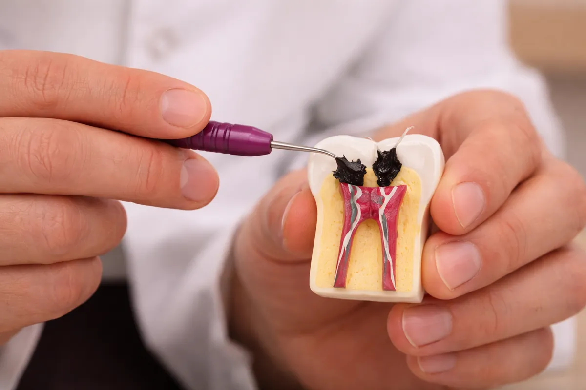 Endodontia