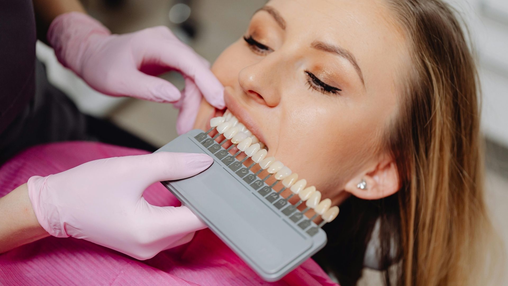 Paciente sorrindo apos clareamento dental em consultorio